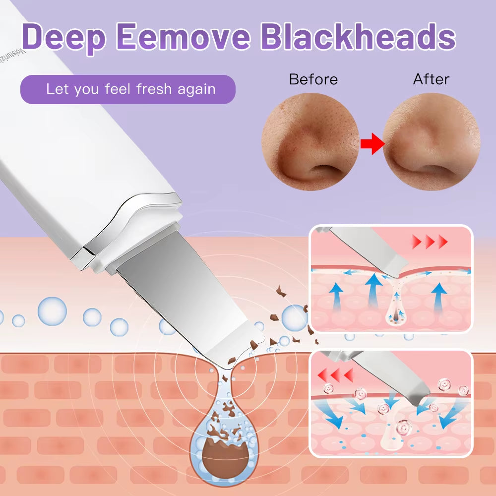 Electric Ultrasonic Skin Scrubber Vibration Face Spatula Peeling Blackhead Remover Facial Lifting Cleansing Ultrasonic Skin Care